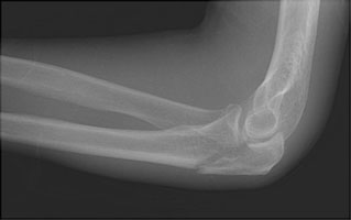  - Click on the image for a larger version