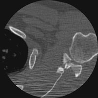  - Click on the image for a larger version