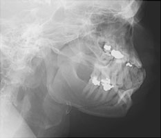  - Click on the image for a larger version