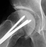 Frog lateral hip - Click on the image for a larger version