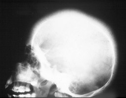  - Click on the image for a larger version